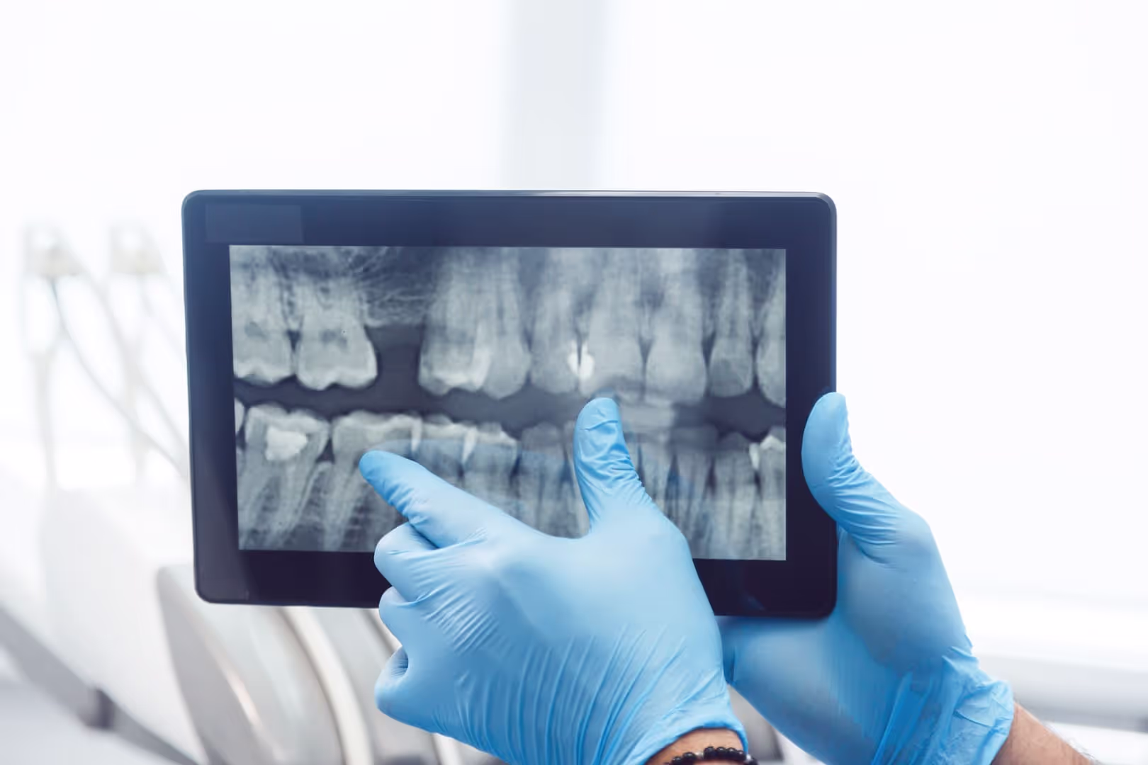 Digital X-rays in Fort Collins – Safe, Fast, and Precise Diagnostic Imaging
