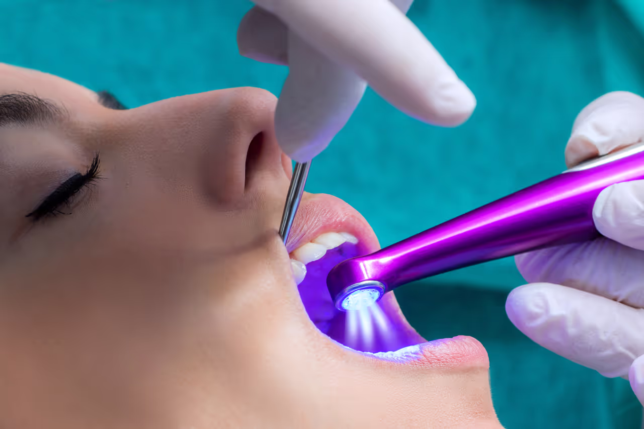 Prevent Cavities with Dental Sealants at Lakeshore Dental