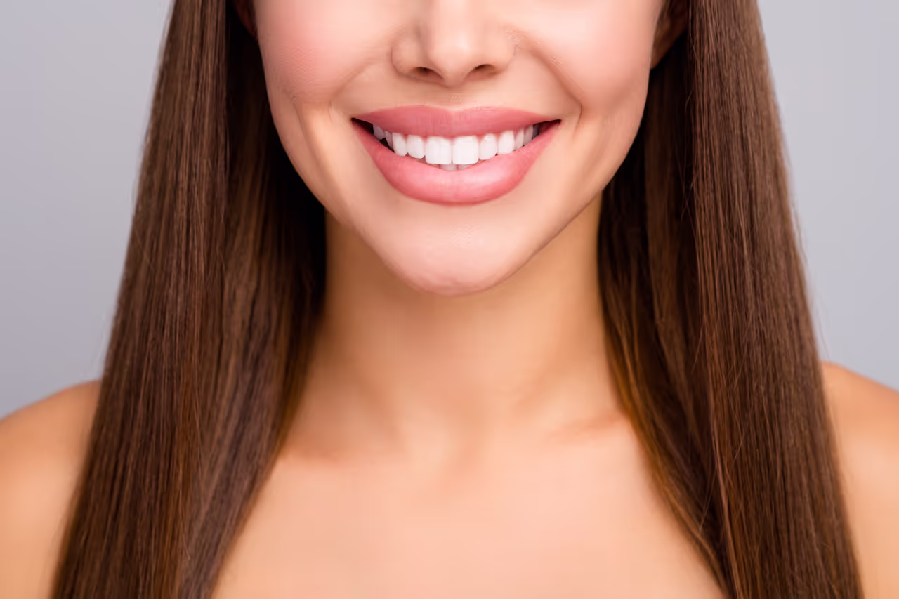Esthetic Veneers & Crowns in Fort Collins