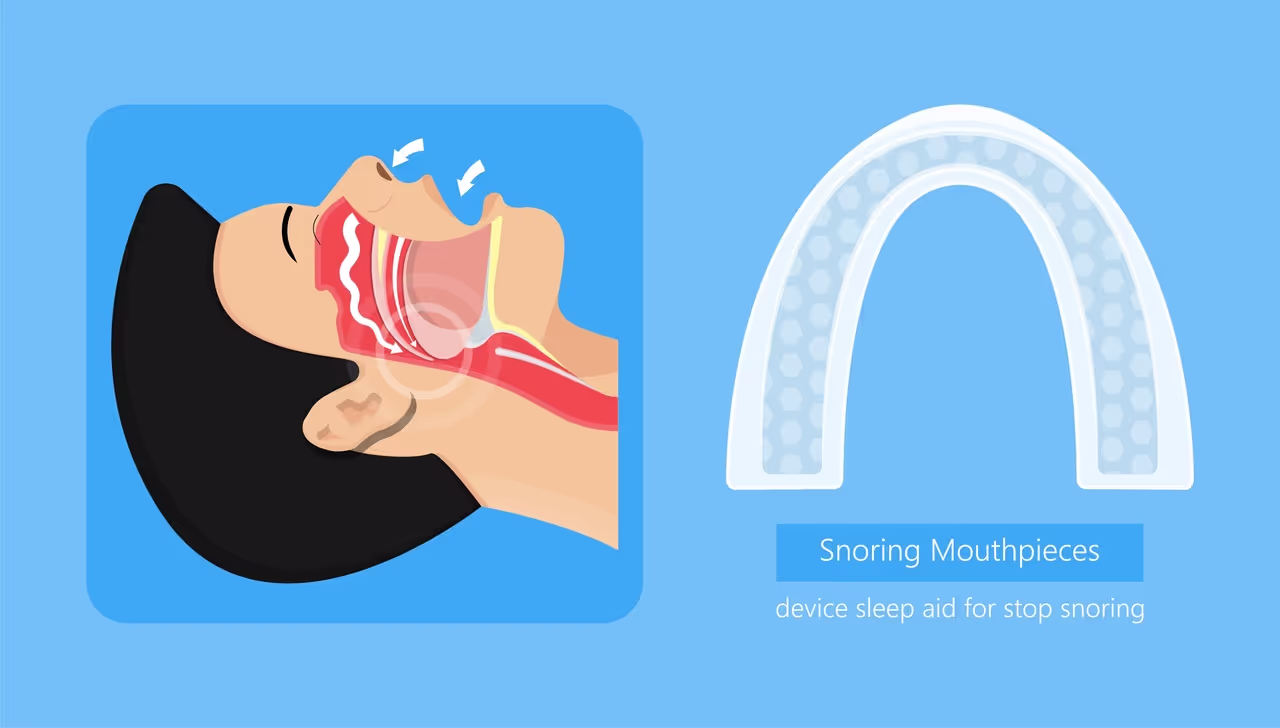 Improve Your Sleep and Health with Custom Snore Guards at Lakeshore Dental